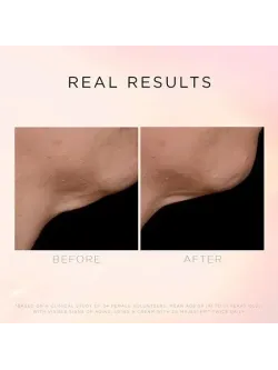 lluminate & Lift Neck & Décolleté Treatment – Крем для кожи шеи и декольте