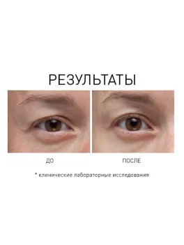 Opti Crystal Liquid Crystal Eye Serum – Сыворотка для кожи вокруг глаз с жидкими пептидами