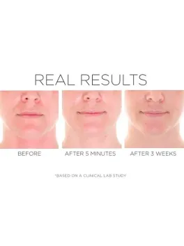 C.P.R. Skin Recovery Serum – Антикуперозная сыворотка